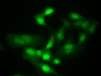 国产自拍高清图片